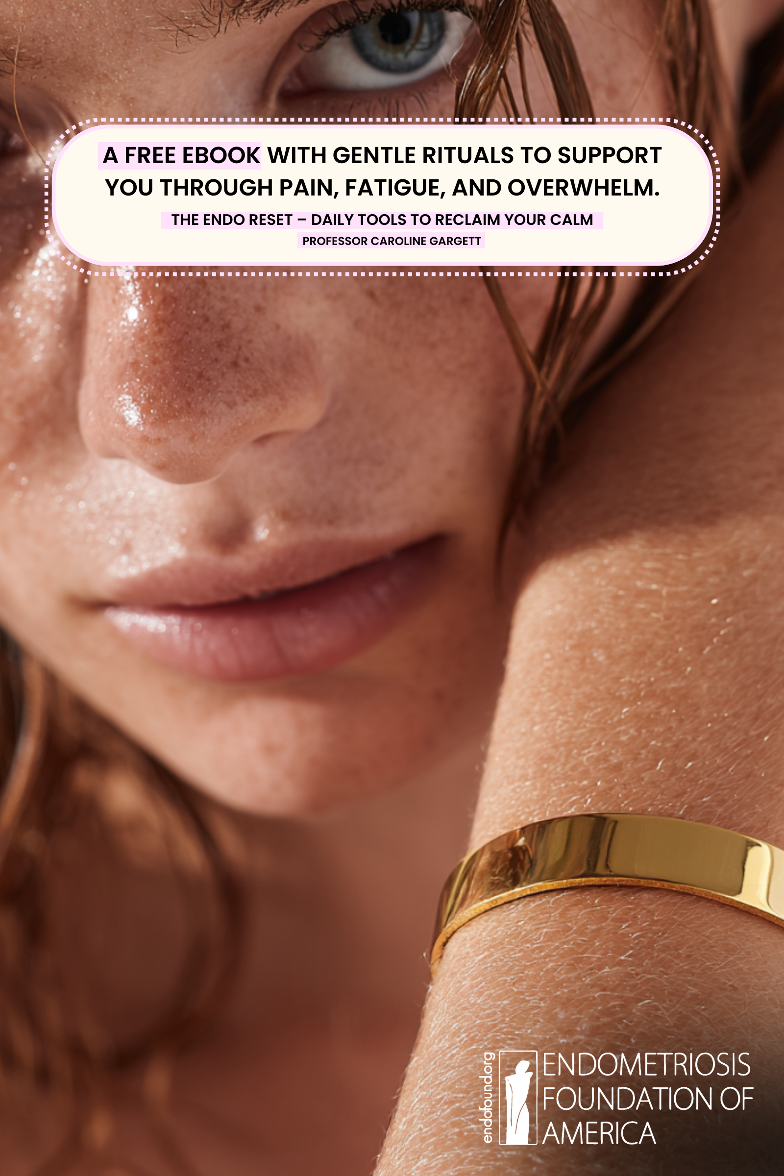 LYRIA BRACELET | YELLOW GOLD CALM